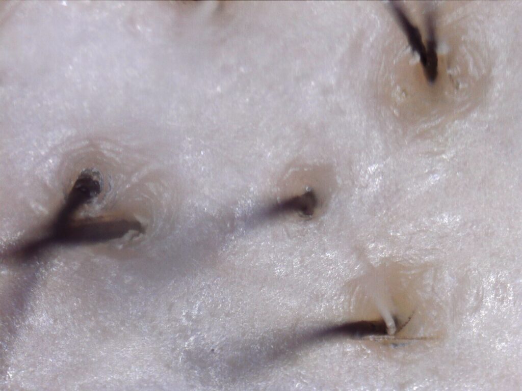 Koolertron デジタル顕微鏡をスタンドから取り外してハンディタイプとして使用し、頭皮を直接チェックした観察画像。毛穴・頭皮の状態・毛根・皮脂が確認できる。スタンド脱着式の一台二役による頭皮チェック用途の実用例。300倍・5メガピクセルで撮影